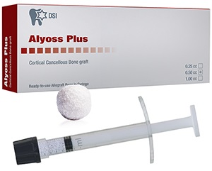 DSI Alyoss