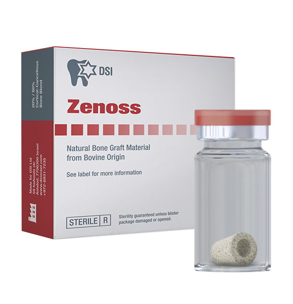 DSI Zenoss Chips